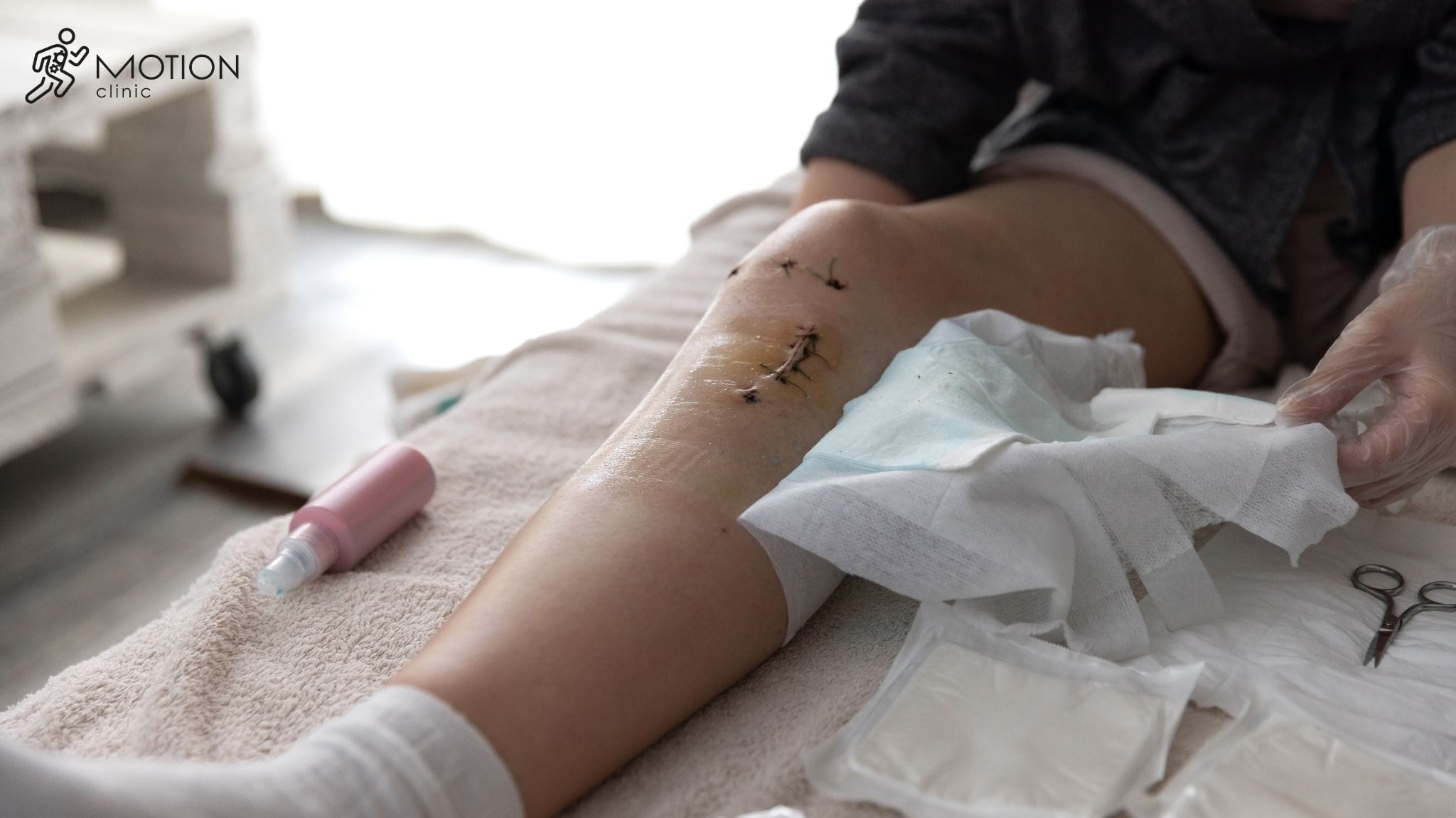 uszkodzenie ACL rehabilitacja MotionClinic